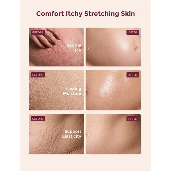 Продукт Momcozy Pro-Collagen Belly - Стягащ и хидратиращ крем против стрии 150гр. - 0 - BG Hlapeta